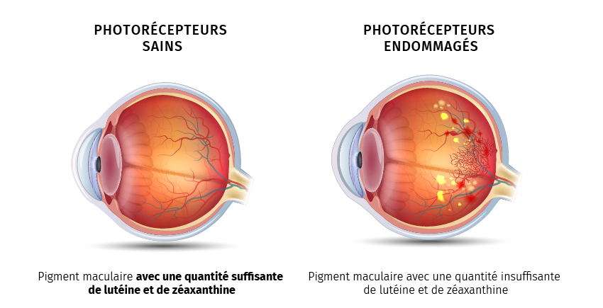 Eye PROtect 1+1 GRATUIT